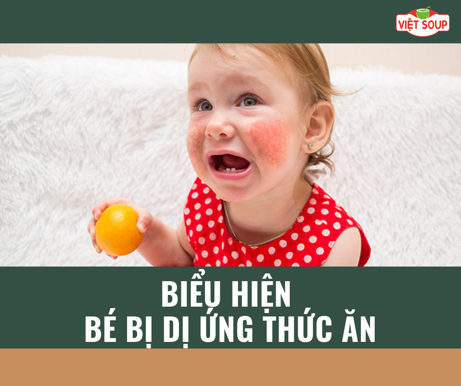 Biểu hiện bé dị ứng thức ăn